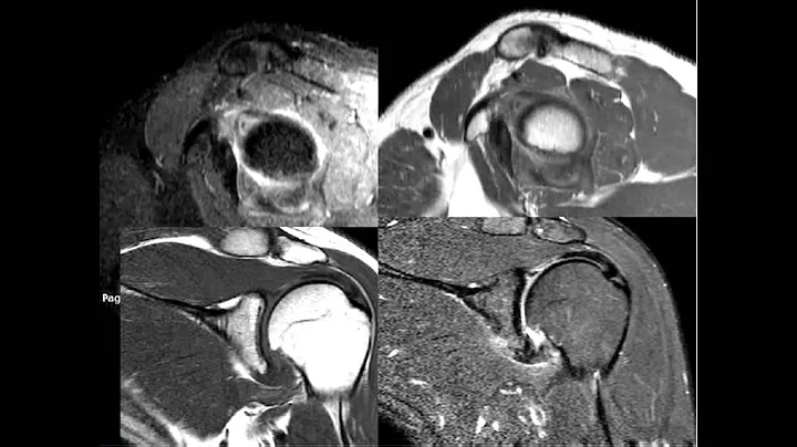 Dr Sumathi Wable Presenting MSK and MRI Cases of Radiology