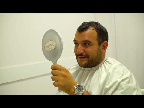 Deamed - თმის გადანერგვა - ნიკა წულუკიძე