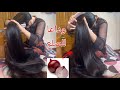 حبة بصل سبحان الله كينبث شعر واخا يكون صلع وكتوقف تساقط في الحين هي لي عتقاتو ليا من الصلع