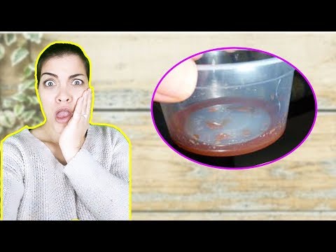 Vidéo: Sang Dans Le Lait Maternel: Est-ce Normal?