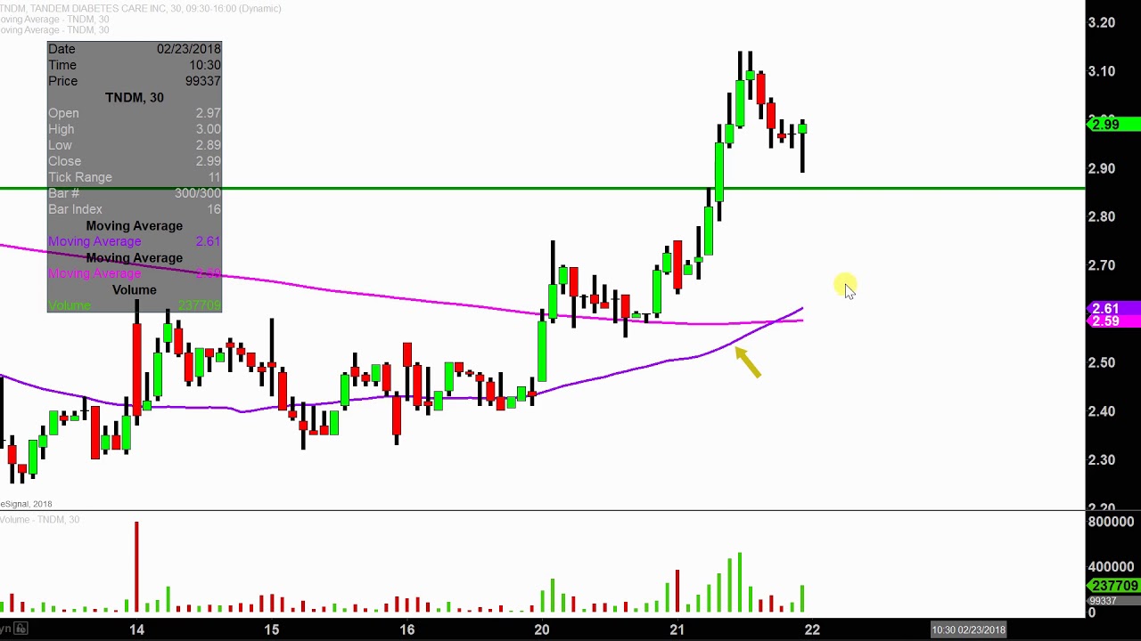 Tndm Stock Chart