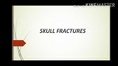 Suspended Animation Forensic Medicine Youtube Suspended Animation Forensic Medicine Youtube