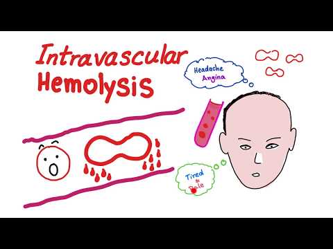 Intravascular Hemolysis
