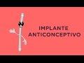 Todo lo que debes saber sobre el implante anticonceptivo