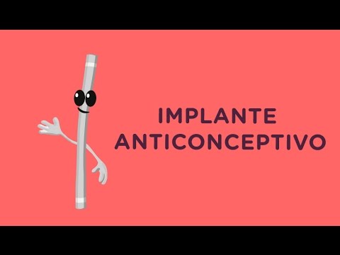 Vídeo: Los Beneficios De Los Dispositivos De Implante Para AFib