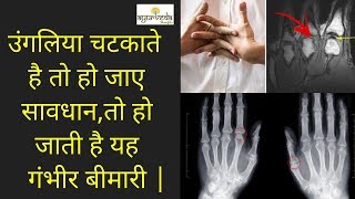 उंगलिया चटकाते है तो हो जाए सावधान,तो हो जाती है यह गंभीर बीमारी || Ayurved Benefits