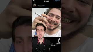 WHY POST MALONE LOST HIS TEETH 🦷😭
