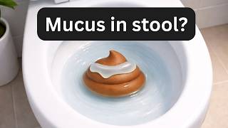 Mucus in Stool: IBS, Infection, or Something Else?