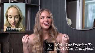 Female FUT Hair Transplant| Hairline Lowering Procedure