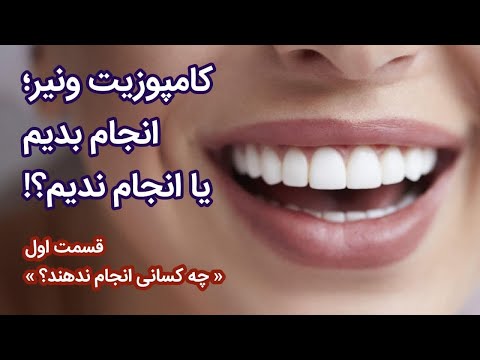 تصویری: لمینت به چه معناست؟