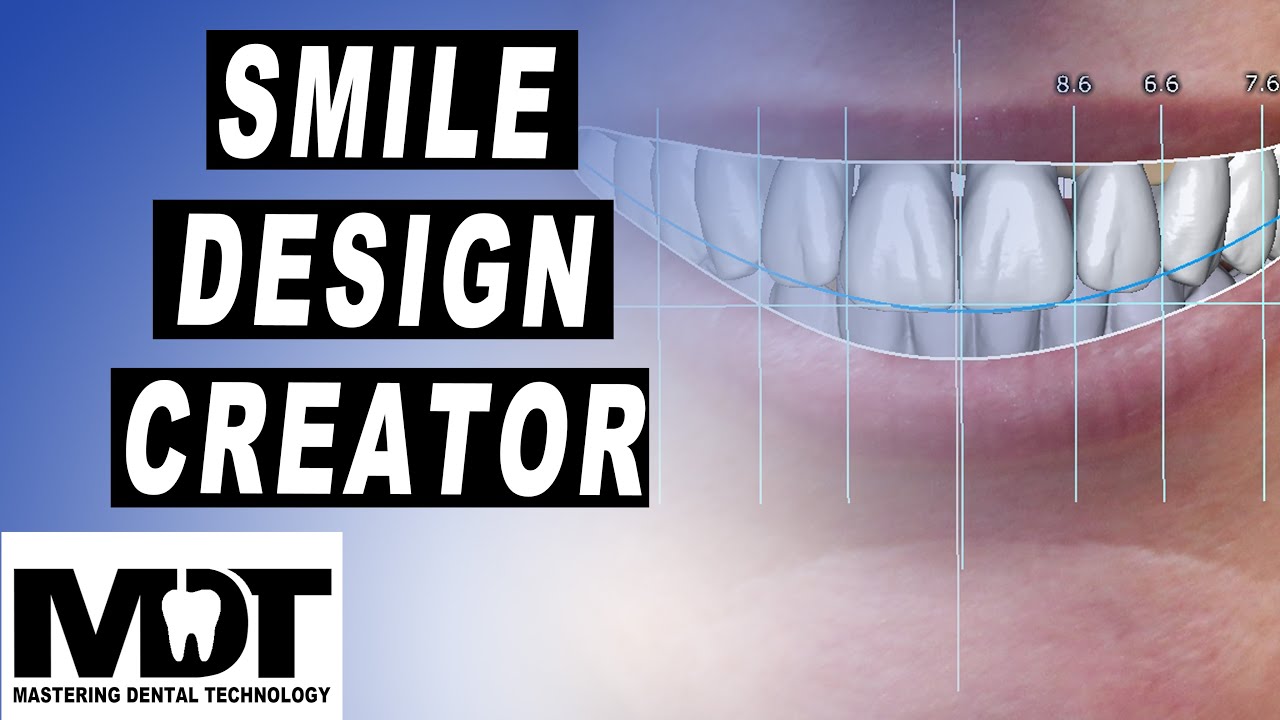 ExoCad Smile Design tutorial for a Wax Up or Crown Design in Plovdiv 2.4