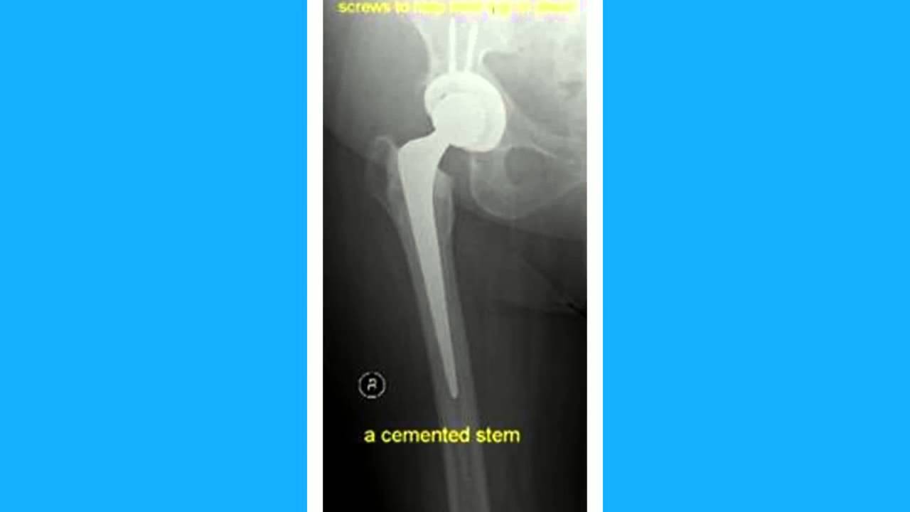 Western Orthopaedic Clinic Subiaco