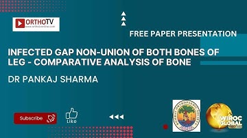 Infected Gap Non-Union of both Bones of leg - Comparative analysis of bone  - Dr Pankaj Sharma