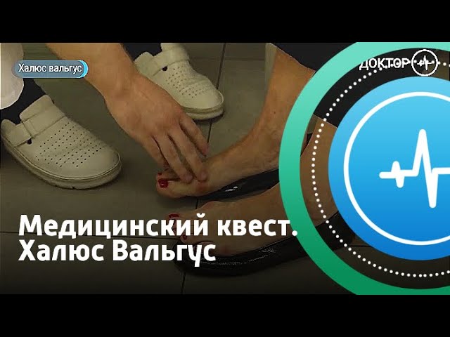 Медицинский квест. Халюс Вальгус | Телеканал «Доктор»