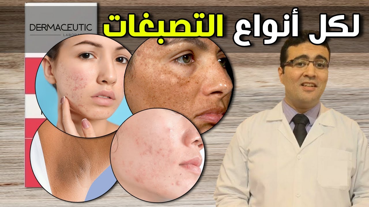 كريم هيعالج البقع والتصبغات والآثار والكلف بفاعلية وأمان