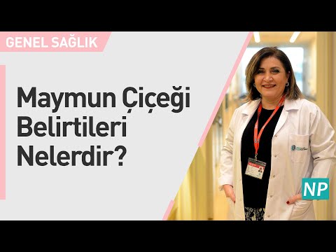 Maymun Çiçeği Belirtileri Nelerdir?