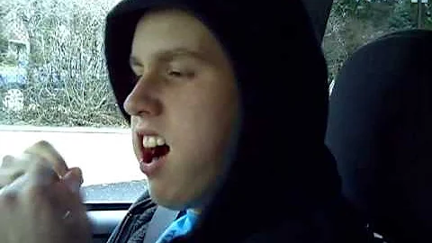 Wisdom teeth Aftermath January 6th 2009