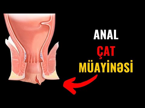 Ksyusha Sobchak va Kseniya Borodina bilan Dom 2-da porno