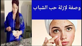 الفنانة سعيدة شرف تقدم وصفة لعلاج البقع و حبوب الوجه saida charaf