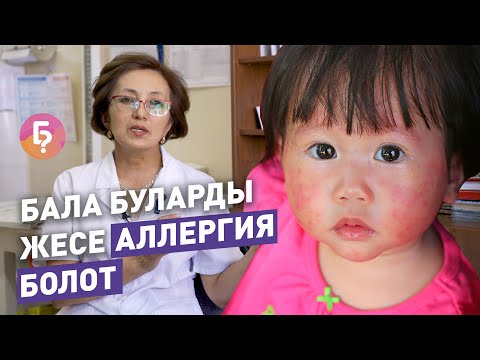 Video: Жаш балдардагы сезондук аллергиянын реакциясын кантип аныктаса болот