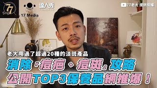 【消除「痘疤、痘斑」攻略公開TOP3保養品網推爆！】｜77老大 