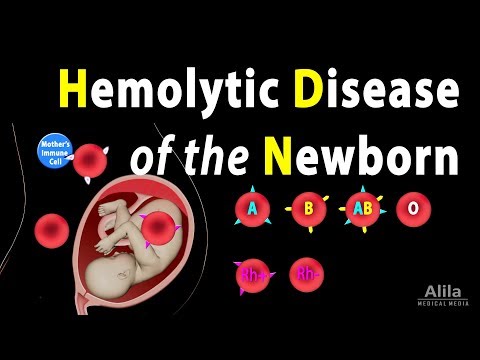 Hemolytic Disease of the Newborn, Animation