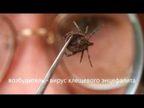 Превью видео
