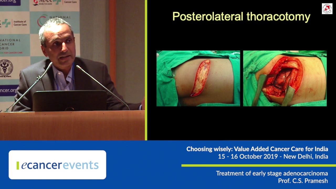 Management of non-small cell lung cancer