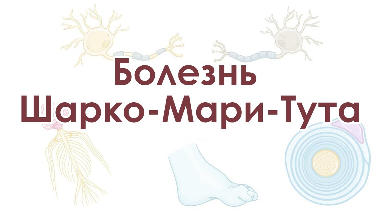 Болезнь Шарко-Мари-Тута
