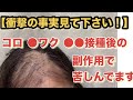 【衝撃の事実見て下さい】コロ●ワク●ン接種後の副作用で苦しんでます