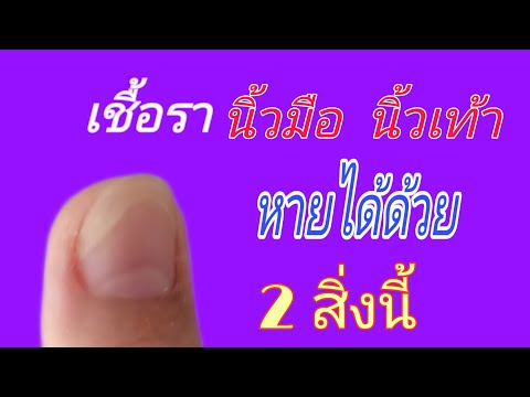 แชร์ประสบการณ์รักษาเชื้อรานิ้วมือได้ผลดี/ฟรีสไตล์byป้าตุ๊ก