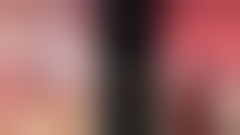 EXPOSED implant due to stage I recession| operation summary step by step