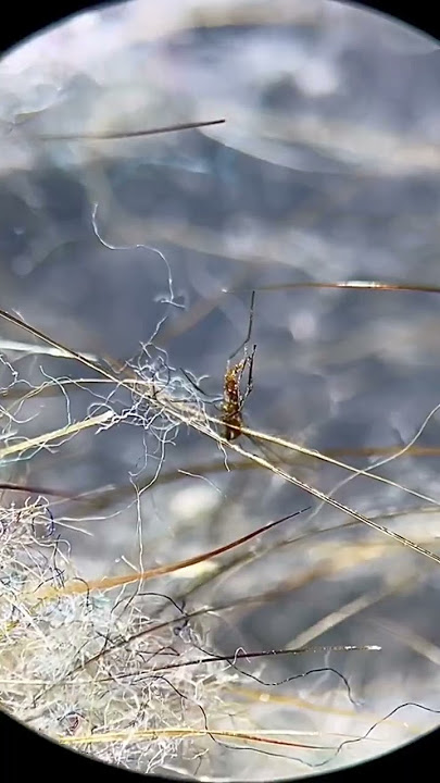 House dust under the microscope!