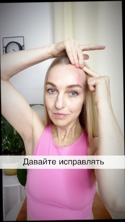 Опущенное веко. Тургор кожи вокруг глаз. #блефаропластика #птоз # ...