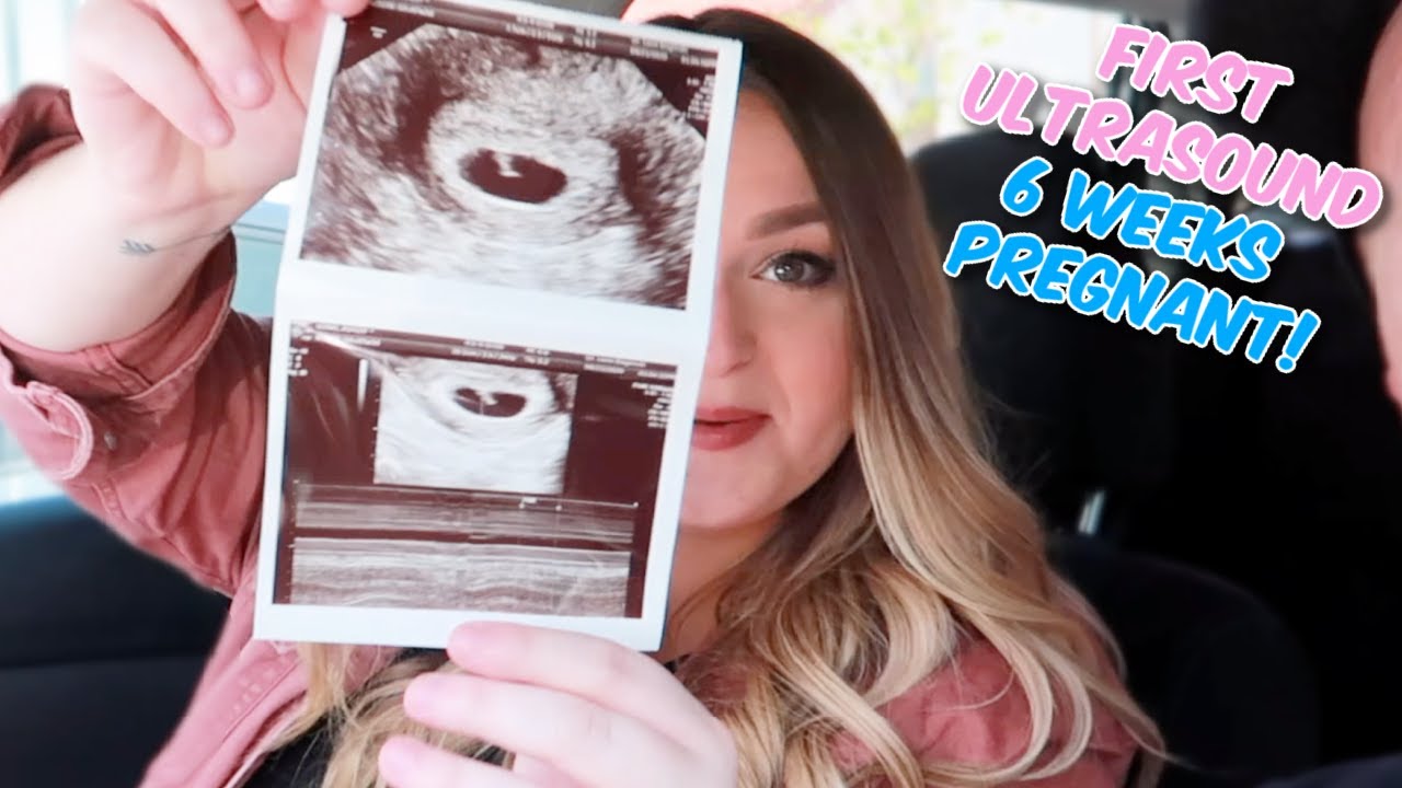 OUR FIRST ULTRASOUND! 6 Weeks Pregnant 2020 👶 - YouTube