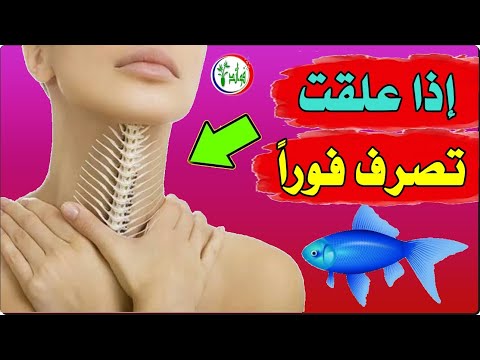 فيديو: كيف تتخلص من السمك