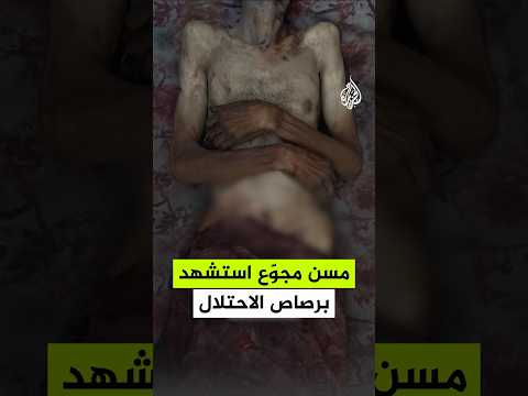 مسن مجوّع استشهد برصاص الاحتلال
