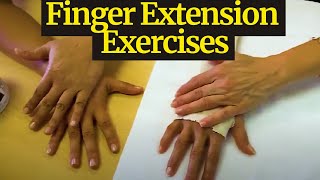 Finger Extension Exercises