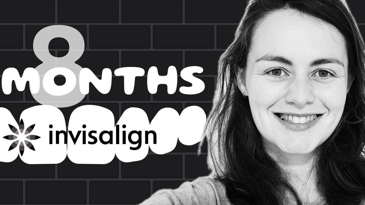 🦷 My Invisalign Journey So Far 😀