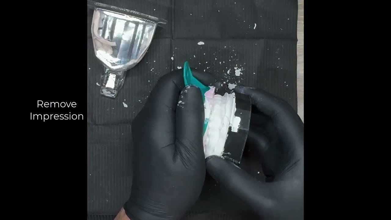 Custom Tooth Whitening Trays using Modelaider® 2025 - Same Visit Trays!