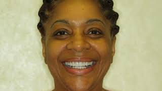 Transforming your Smile can transform your Life @ Water Tower Dental Care in Chicago.