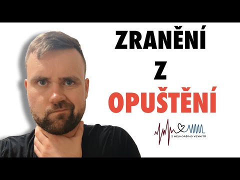 Video: 4 způsoby, jak být scénou Anak