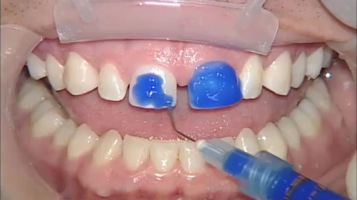 No Prep Vivaneers with Prismatik ThinPress