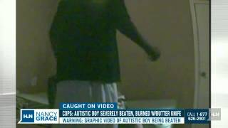 Autistic Victim Beaten On Tape, Mom Speaks