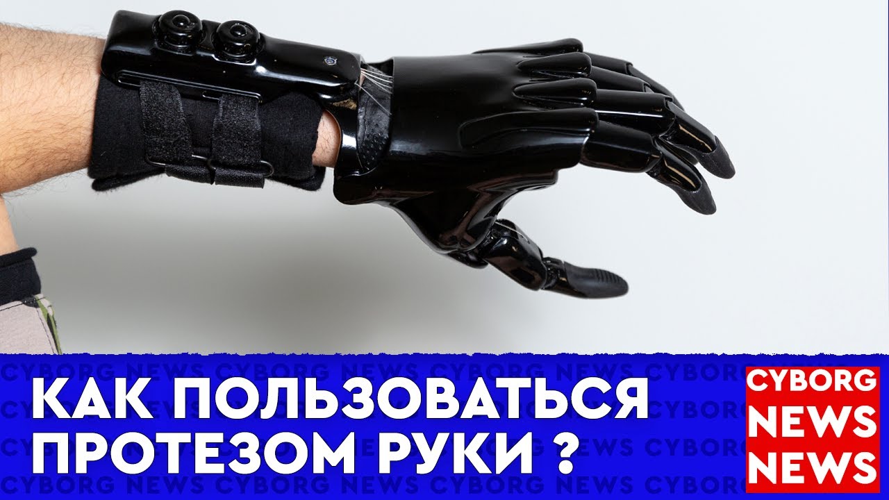 Влог | Протез руки | Как пользоваться протезом | реабилитация людей с ...