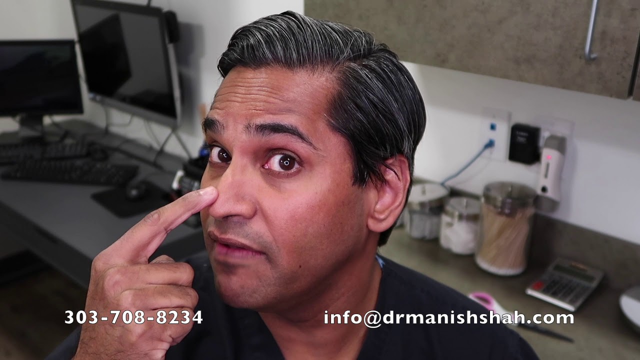 Как справиться с отеком после ринопластики