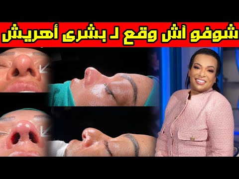 شوفو شنو وقع للفنانة المغربية بشرى أهريش