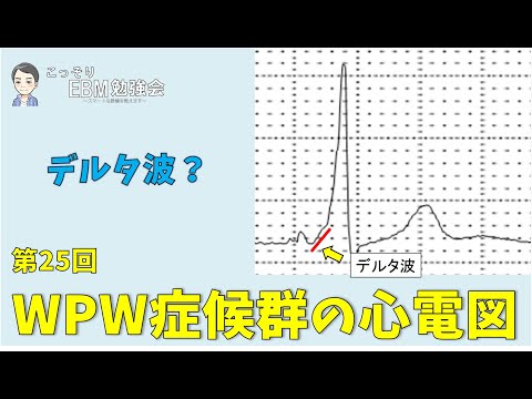 【心電図】第25回　分かる！WPW症候群の心電図