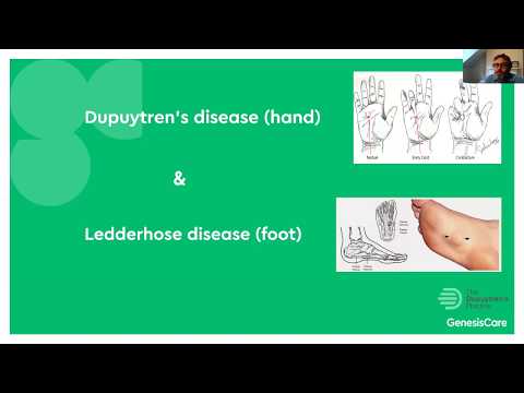 Radiotherapy Q&As