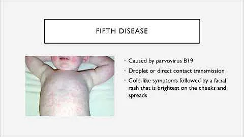 BIO 205 - Chapter 21 - Skin and Eye Infections
